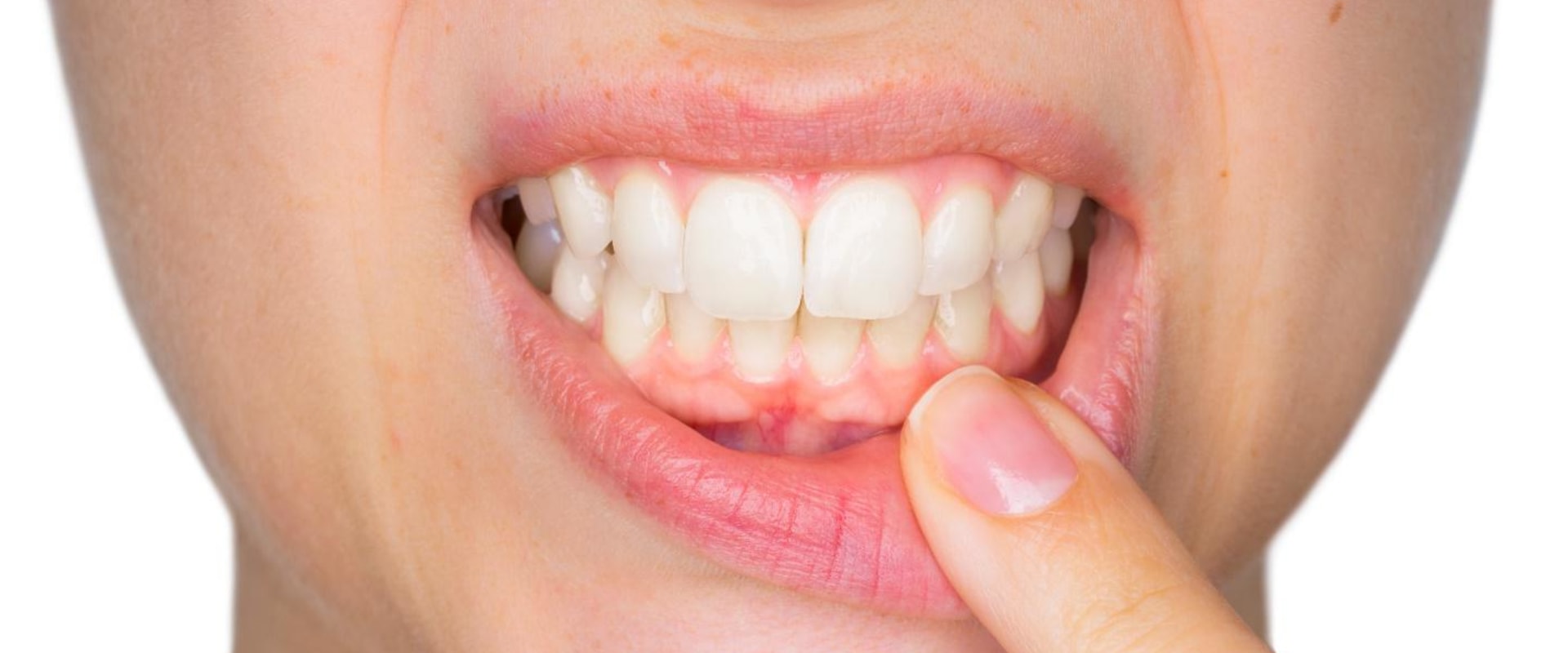 Can gum health be restored?