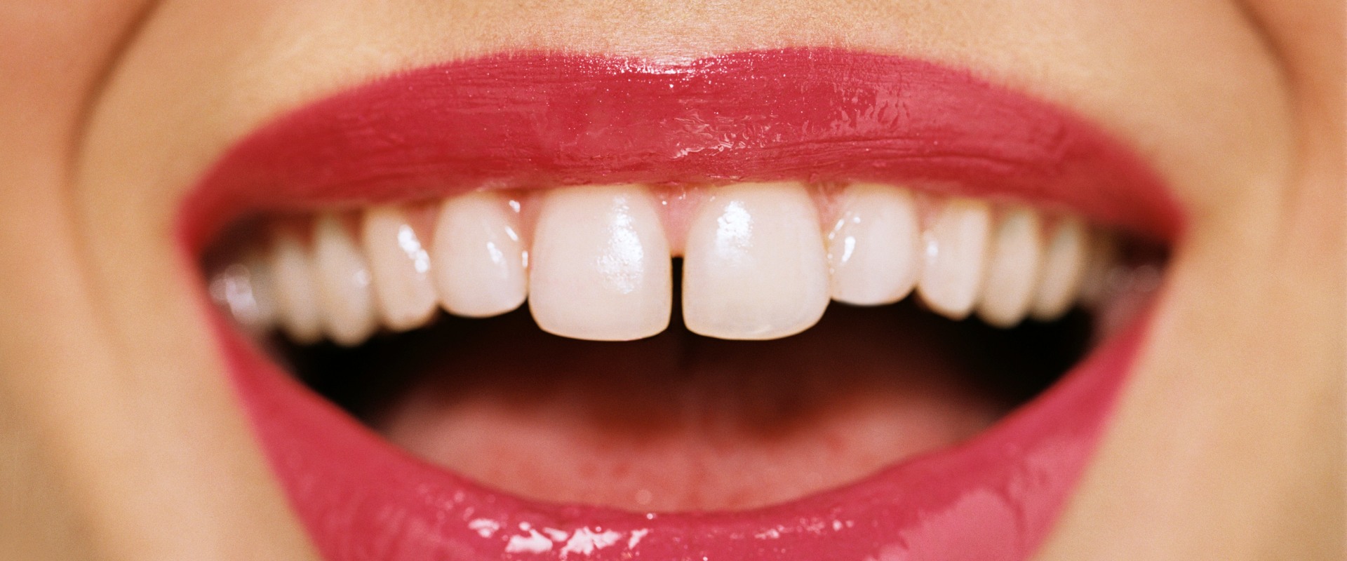Can your gums get healthy again?