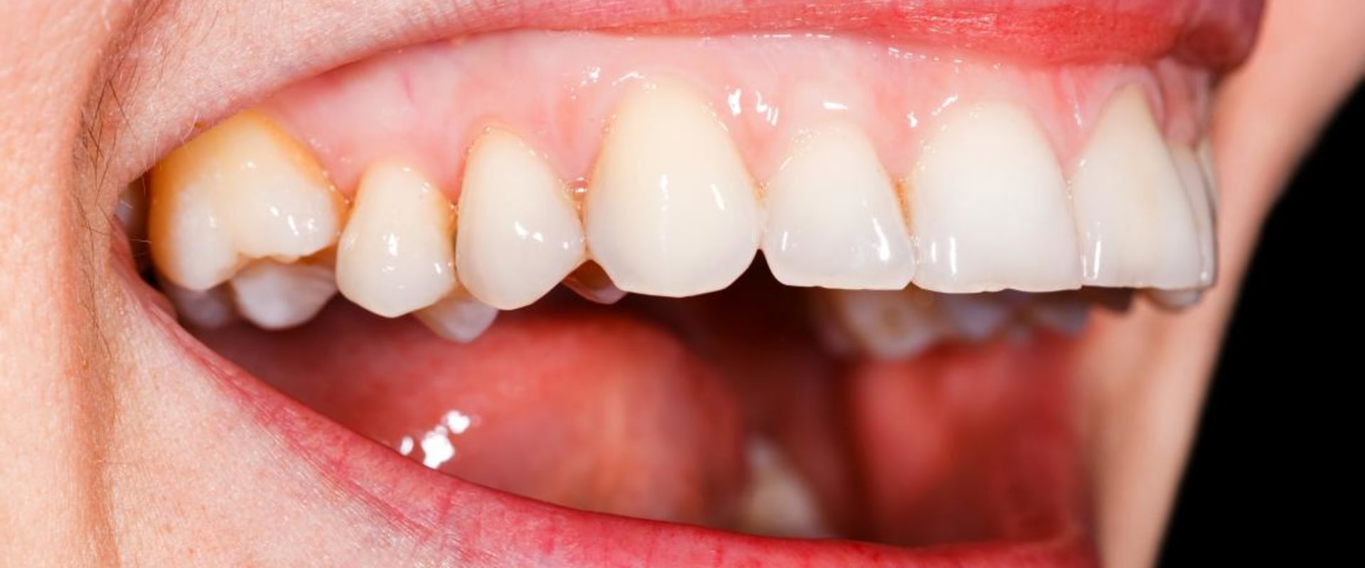 How do you check if your gums are healthy?