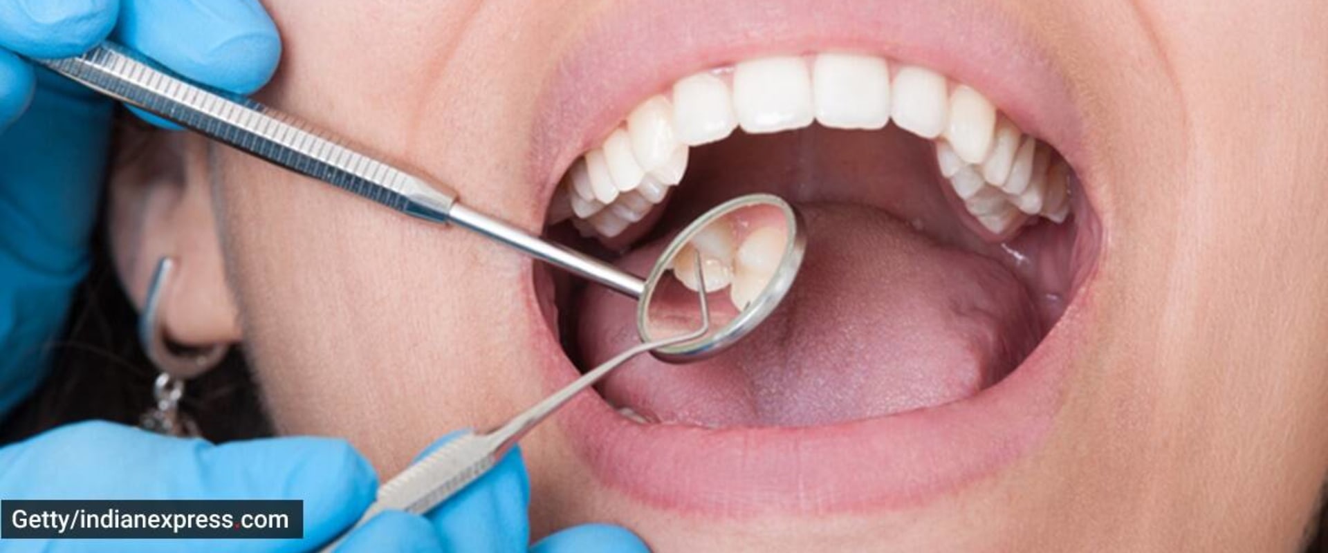 What dental health?