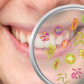 Why is oral health important who?