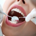 Who oral health care?