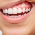 Can gum health improve?