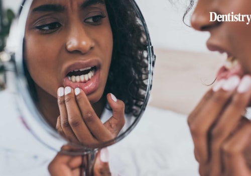 Can oral health affect skin?